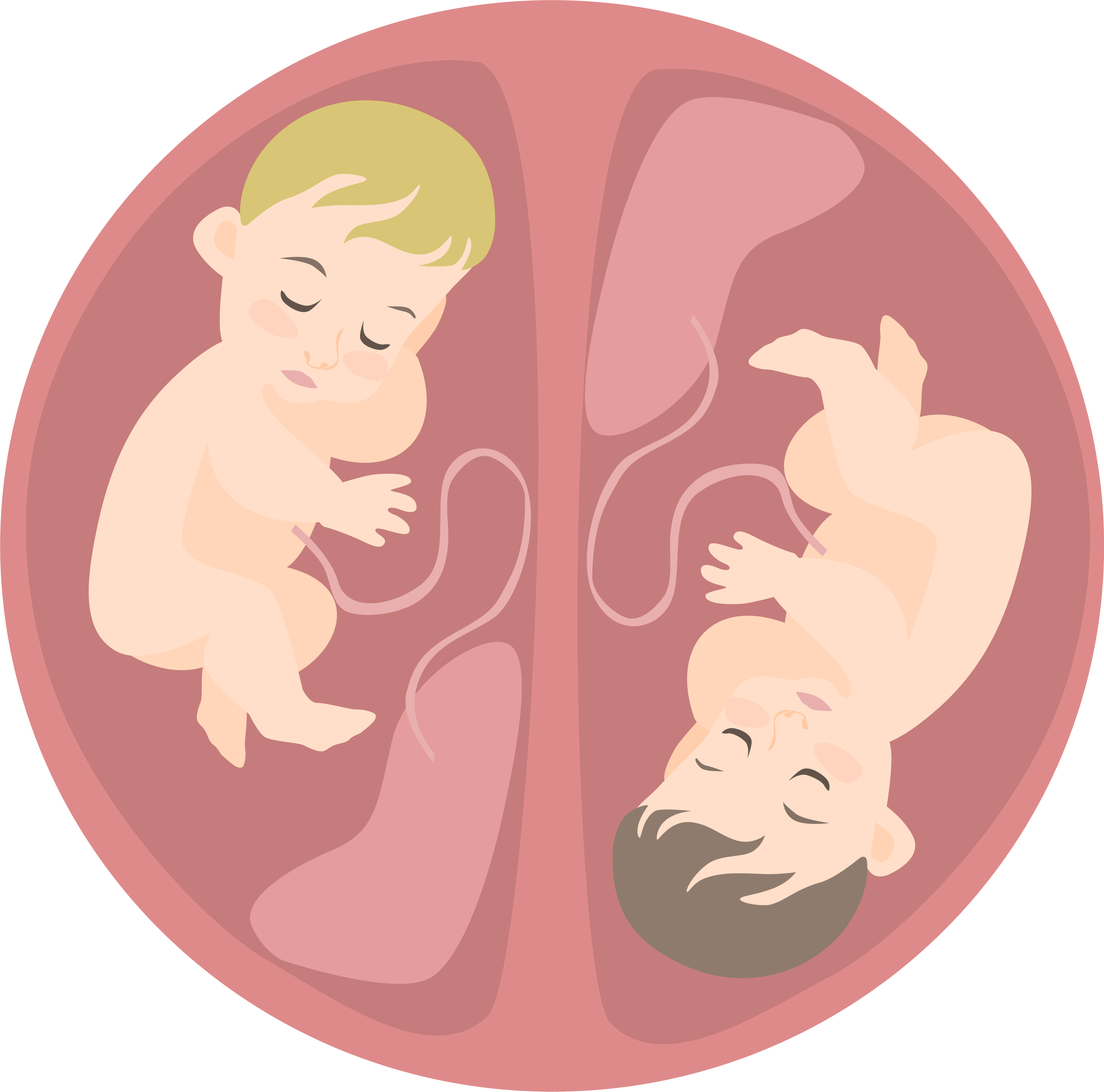 Miért nem ajánlott lombik program esetén az iker-beültetést? 